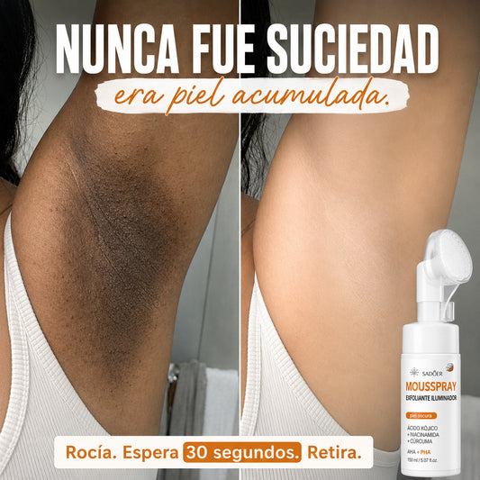 Mousspray Exfoliante e Hidratante de Piel - Zonas Oscuras y Ásperas